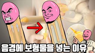 발기부전 보형물 재수술 하는 이유