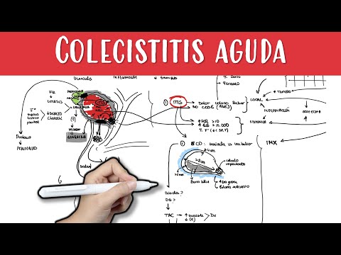 COLECISTITIS AGUDA #colecistitis