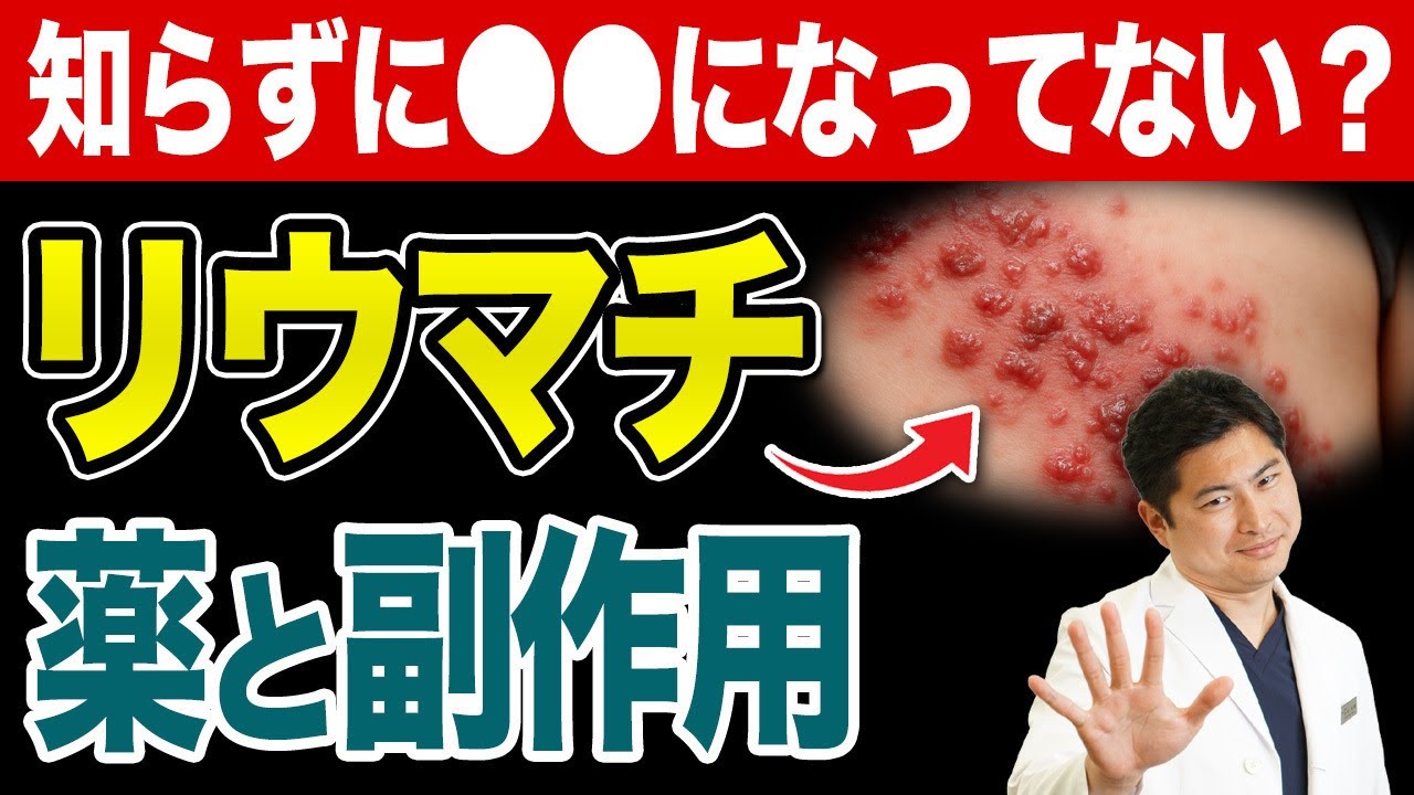 【リウマチ】バイオシミラーってどう選ぶ？高額治療の不安をなくす薬の選び方ガイド【バイオシミラー/関節リウマチ】