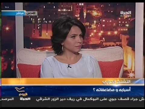 التشنج الحراري