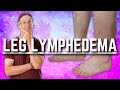 Top 3 Exercises for Leg Lymphedema (Swelling or Edema)