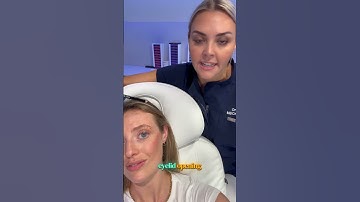 Botox brow lift hack 💉
