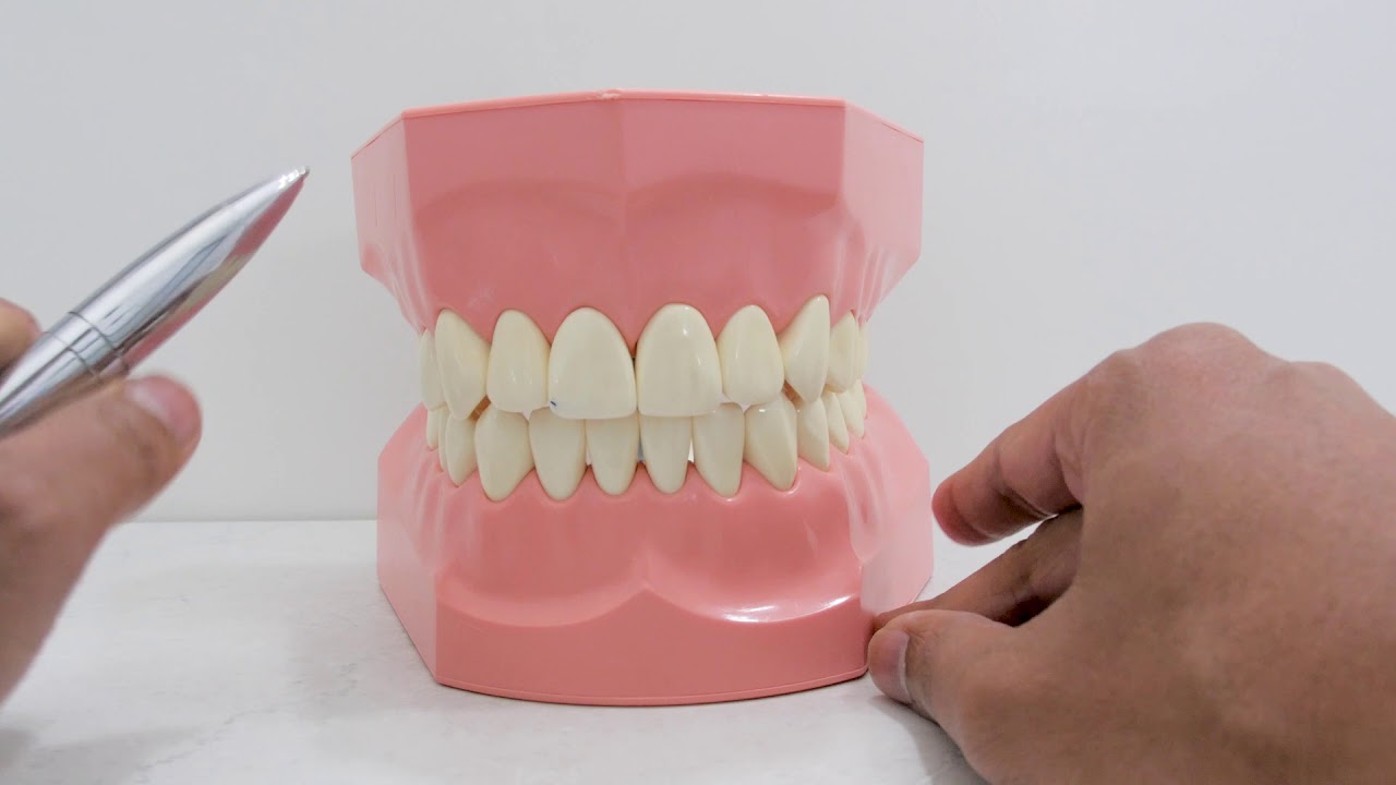 Dental Assistant Training Dental Charting (FDI) YouTube