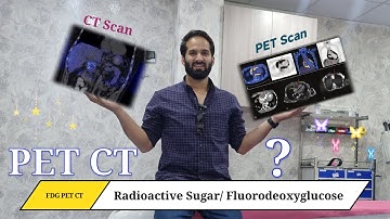 PET-CT Scan Explained | How It Works, History & Uses | By Anis Qureshi