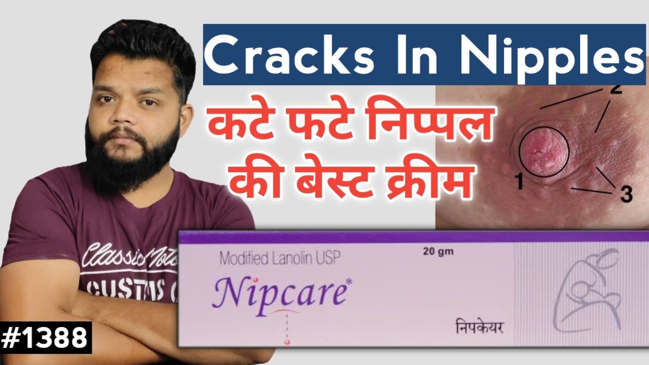 cream-for-cracks-in-nipples-nipcare