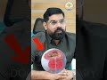 പുരുഷന്മാർ ഈ ലക്ഷണങ്ങൾ Ignore ചെയ്താൽ വലിയ പ്രശ്നമാകും 🚨