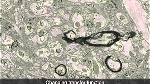 Interactive Volume Exploration of Petascale Microscopy Data Streams