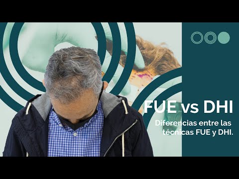 🔹Diferencias entre técnica FUE y técnica DHI | Injerto con RAPADO vs Injerto SIN RAPAR 📣 hqdefault