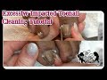 👣 Pedicure Tutorial Cleaning Excessive Impacted Toenail Buildup 👣⭐