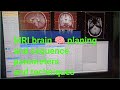 Mastering mri brain planning techniques and sequencing  philipsmri 3tesla