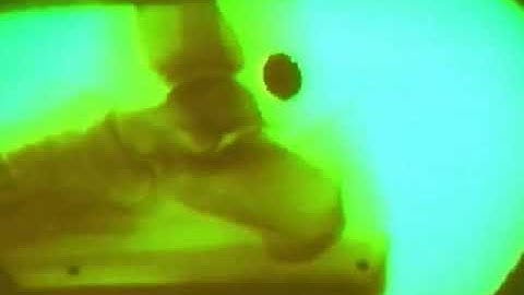 Barefoot vs Shod Fluoroscopic Running Video of Foot