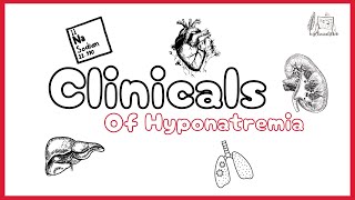 Clinicals I Learned From The Case Of Hyponatremia Its Myclinicalbook