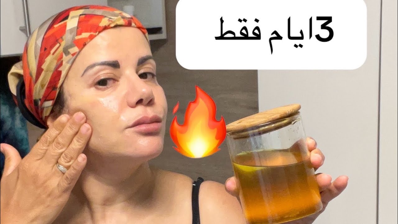 وصفة جبارة 💥لازالة التجاعيد والبقع #حتى لو عمرك 60سنة #ضعيها على الكلف وستختفي نهائيا 💞