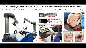 Autonomous System for Tumor Resection (ASTR)-Dual-Arm Robotic Midline Partial Glossectomy, ICRA 2024