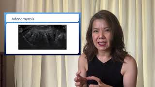 MIRACLE BABY | Episode 3 | Endometriosis \& Infertility (Taglish)