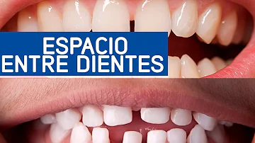 ¿Por qué mis dientes son redondeados y no cuadrados?