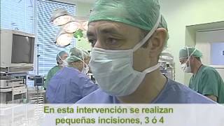 Cirugía Mayor Ambulatoria. Andalucía.