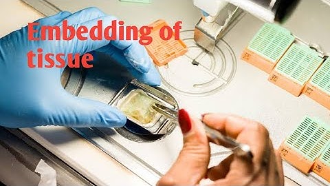 Embedding /Embedding of tissue/Embedding of tissue procedure