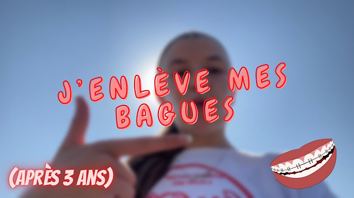 J’enlève mes bagues après 3 ans ( c’est pas trop tôt ) #vlog