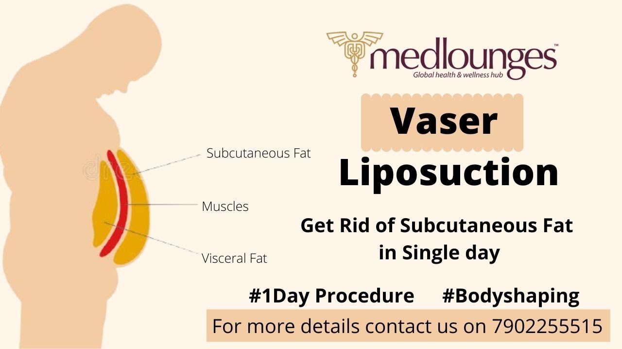 VASER LIPOSUCTION 1 DAY PROCEDURE MEDLOUNGES Dr. Joseph Thomas