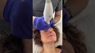 Non-surgical Eye lift with Thermage FLX | The Cosmetic Skin Clinic