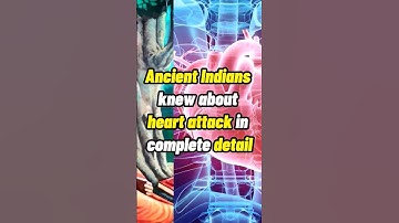 Ancient Indians Knew About Heart Attacks! #shorts #hinduism #templearchitecture