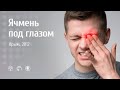 РИЦИНИОЛ. Ячмень под глазом. Отзыв