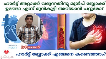 Heart block to know early | Heart block treatment malayalam | Heart block maran malayalam