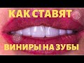 Виниры для зубов,  виниры видео как ставят Киев ЛюмиДент