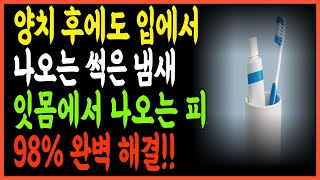 2주 만에 구취·잇몸 출혈 없앤 양치 후 한 가지 습관｜입에서 썩은내가 사라졌습니다｜치과의사도 놀란 변화ㅣ노후건강ㅣ노후지혜ㅣ행복한노후ㅣ오디오북