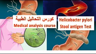 ميكروب حلزوني H. pylori in stool Ag#حسين_للعلوم