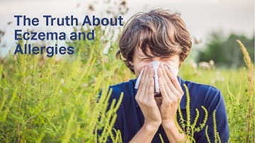 The Truth About Eczema and Allergies