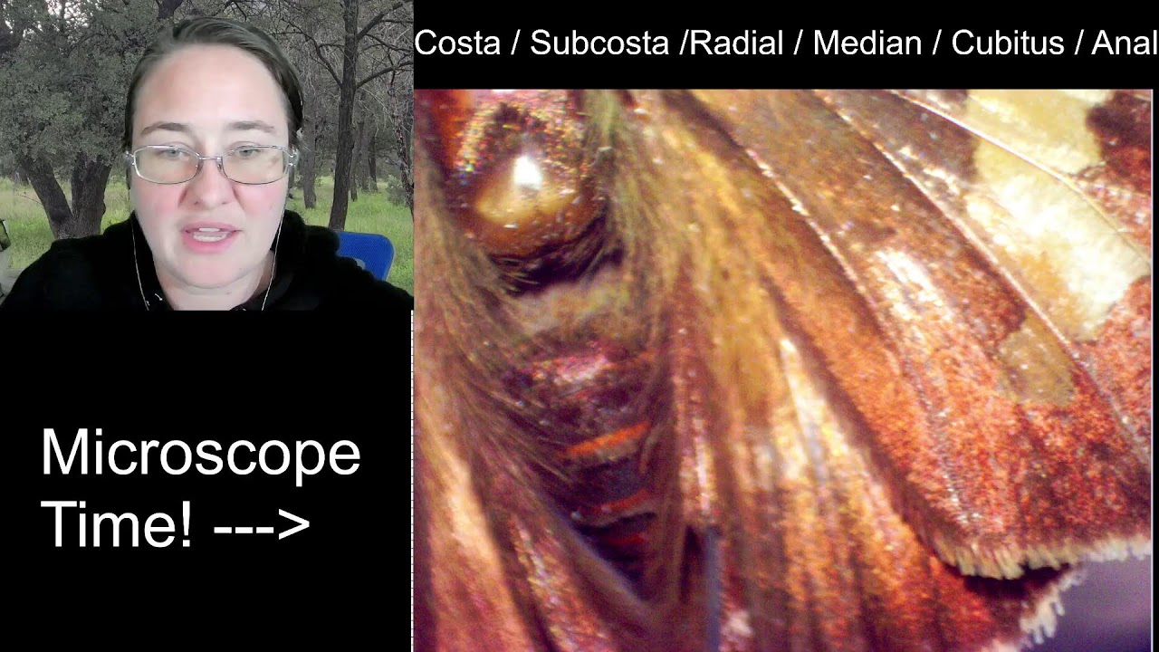 Insect Illustrations Under a Microscope: Silver-Spotted Skipper (Epargyreus clarus)