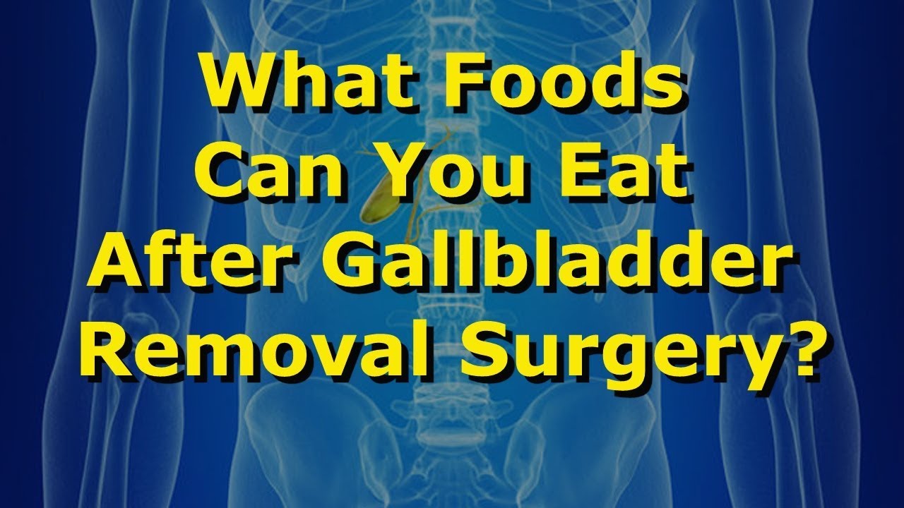 What Foods Can You Eat After Gallbladder Removal Surgery? - YouTube