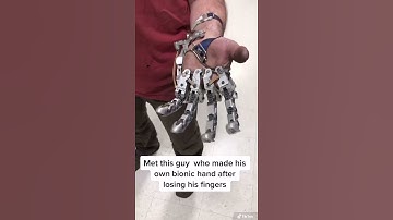 This guy made his own bionic hand after losing his fingers #tech #technology #futuretechnology