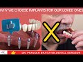 Dental implants for you loved onewhy to choosemajor benefits of implants dentalimplants