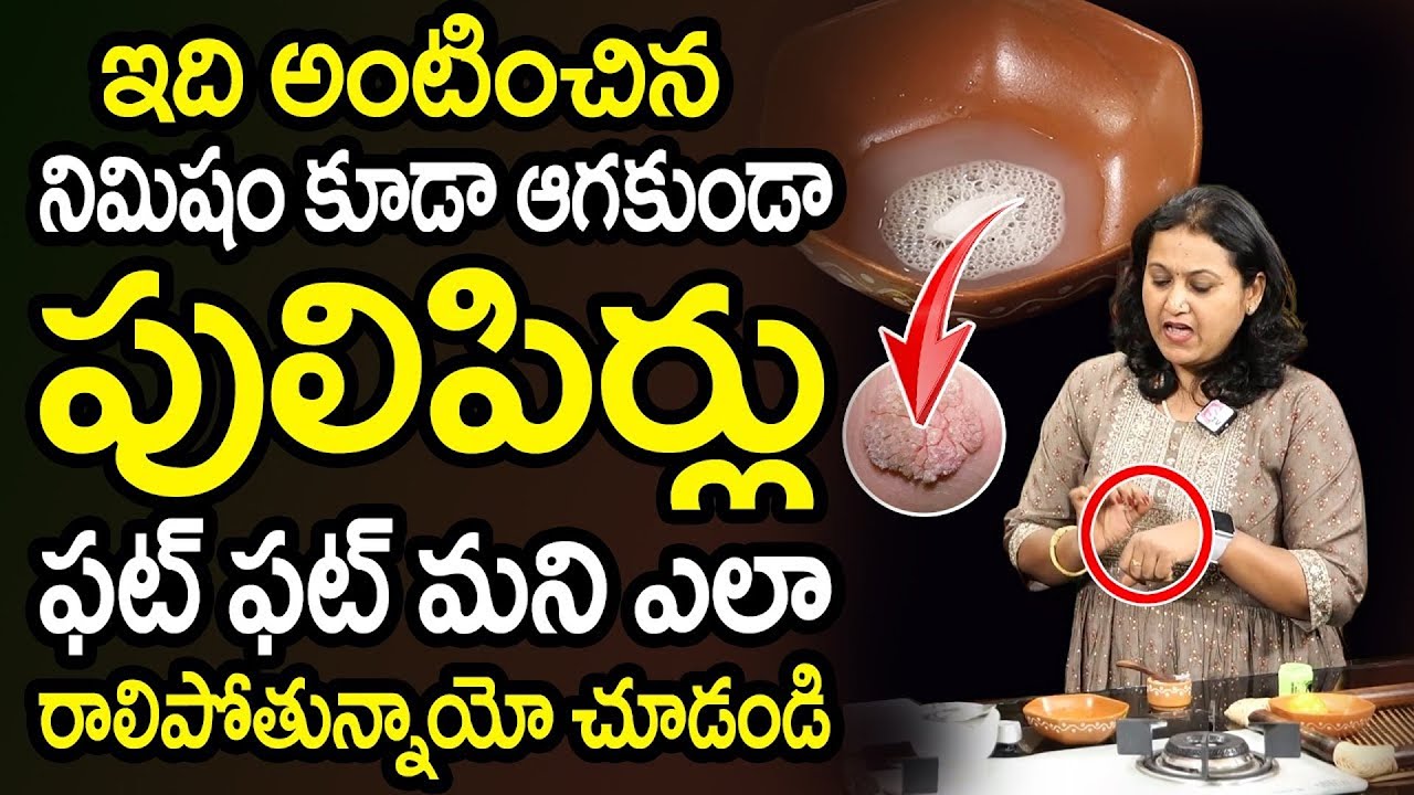 Dr. Jyothsna Pulipati - నొప్పి లేకుండా పులిపిర్లు మాయం || || Home Remedies For Pulipirlu || SumanTv
