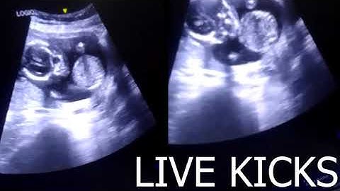 LIVE KICKS | Dr. Arpita Bajpai | Aatmaram Healthcare |