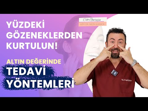 Gözenekler nasıl daraltılır ? Nasıl yok edilir? Gözenek Problemleri