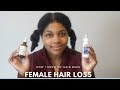 FEMALE HAIR LOSS | How I Grew My Hair Back! | UPDATE |