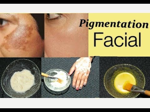 How To Get Rid of Hyper Pigmentation- Freckle, Dark Spots, Acne Scars/% Effective Home Remedies