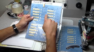 Dentures:  How to Select Anterior Denture Teeth