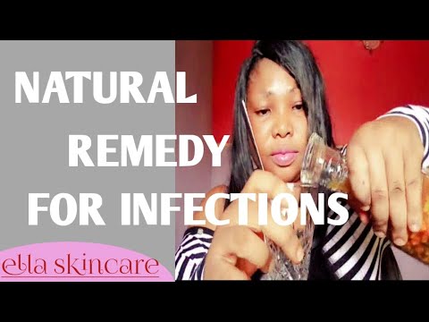 DIY NATURAL CURE FOR ALL INFECTIONS / HOW I CURE INFECTION AT HOME