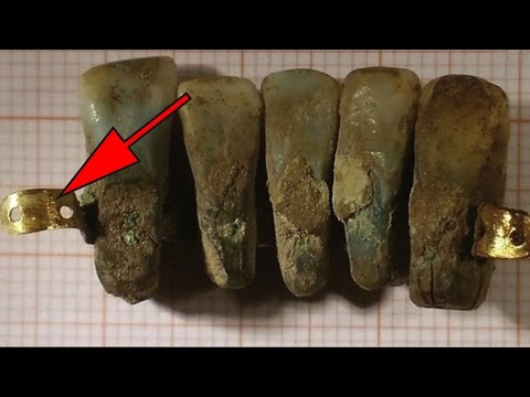 400 Year Old False Teeth Found In Italy Archaeological Discoveries