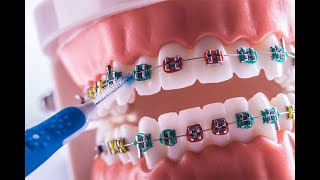 BIOPSIA Importancia para el odontologo en general, indicaciones y contraindicaciones, procedimient BIOPSIA Importancia para el odontologo en general, indicaciones y contraindicaciones, procedimient