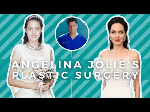 Angelina Jolie's Plastic Surgery Before And After | Evaluated by a Plastic Surgeon