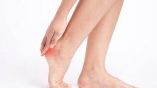 heel  pain relief Dr Rubi choudhary// heel pain physiotherapy heel rehabilitation