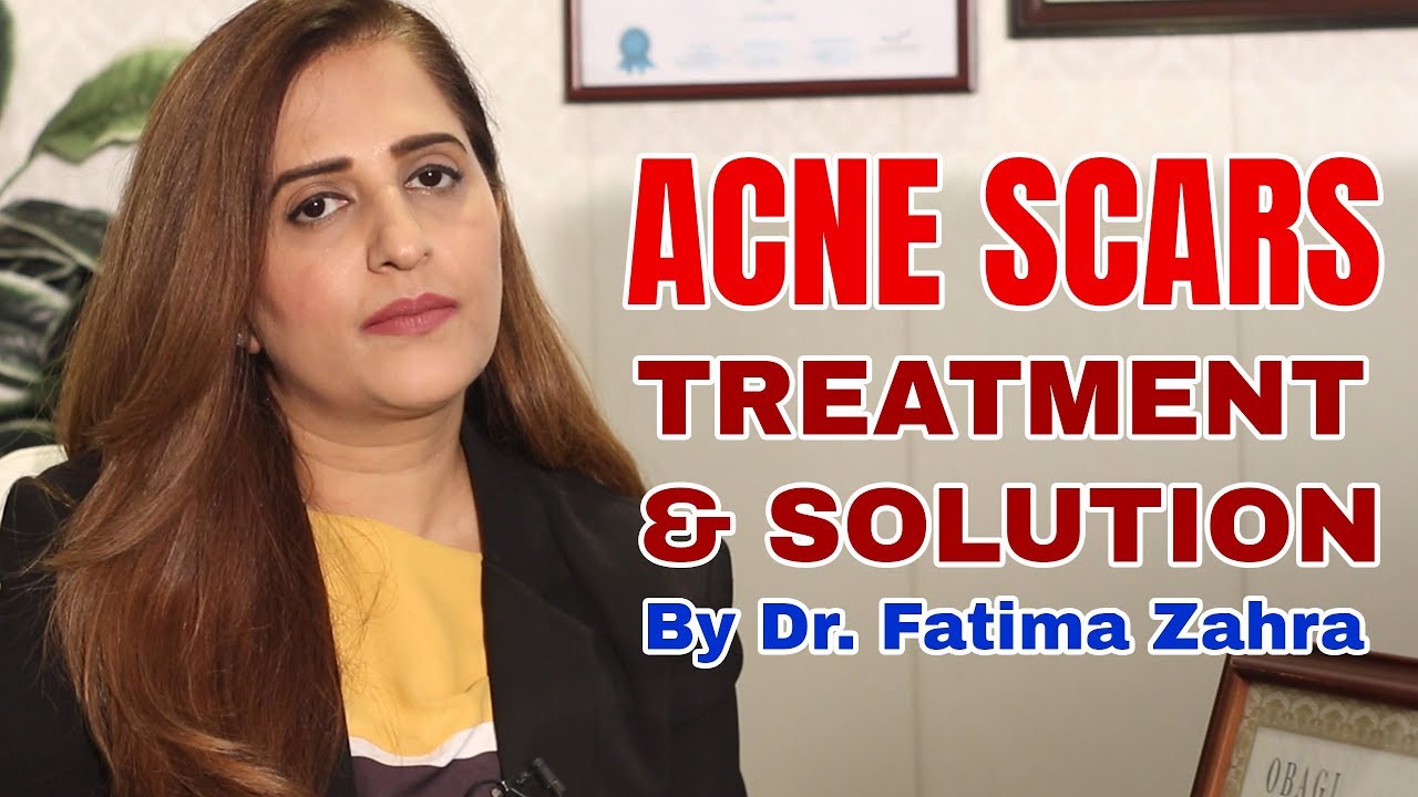Acne Scars Treatment, Laser Acne Scars Removal & PRP Platelet Rich Plasma Treatment For Acne