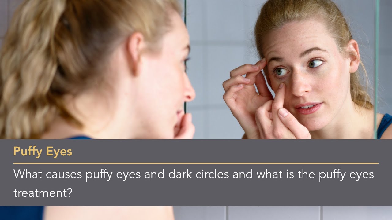 Effective Solutions For Puffy Eyes : Causes And Remedies - Blog