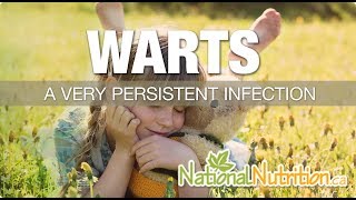 Natural Health Reviews - Warts Skin Infection: Causes, Symptoms & Treatment | National Nutrition